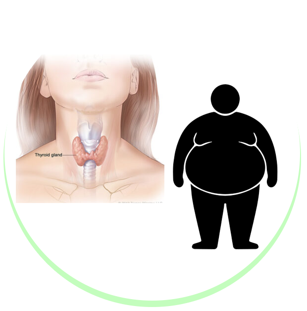 Obesity, Thyroid & Lifestyle Diseases